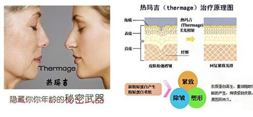https://img.yiyiaimei.com/timg/160222/14153111J-1.jpg