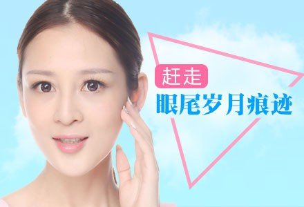 深圳国产衡力肉毒素祛鱼尾纹-