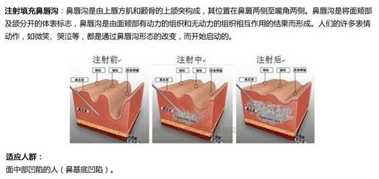 案例图片