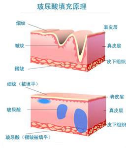 案例图片