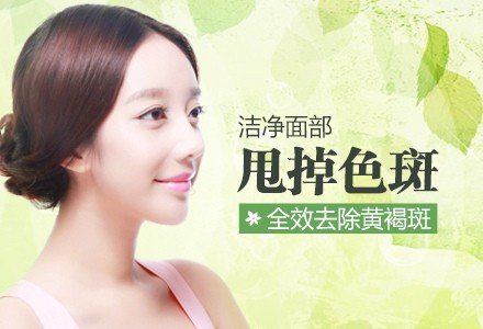 武汉激光光子联合去除黄褐斑-
