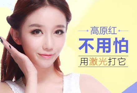 石家庄激光去红血丝-