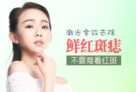 武汉激光光子全效去鲜红斑痣-