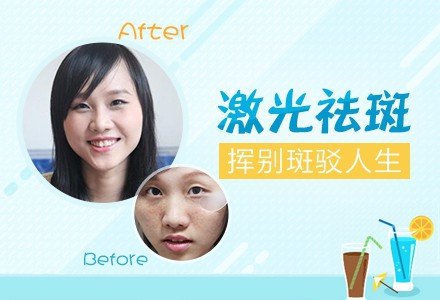 广州激光面部祛斑-