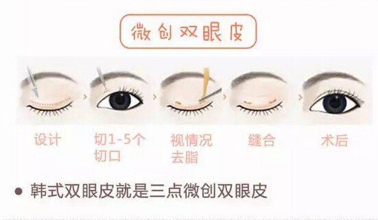 案例图片