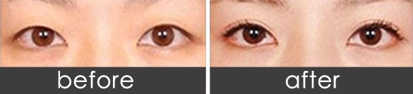 https://img.yiyiaimei.com/timg/160222/164451IP-0.jpg