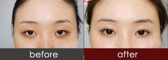 https://img.yiyiaimei.com/timg/160222/164PI251-1.jpg