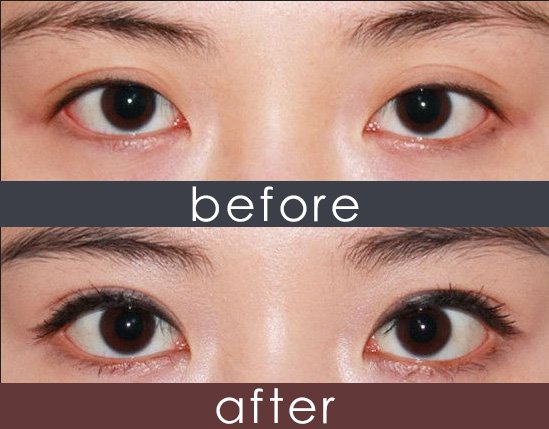https://img.yiyiaimei.com/timg/160222/1A0393E9-0.jpg