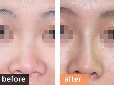 https://img.yiyiaimei.com/timg/160222/1A2362160-0.jpg