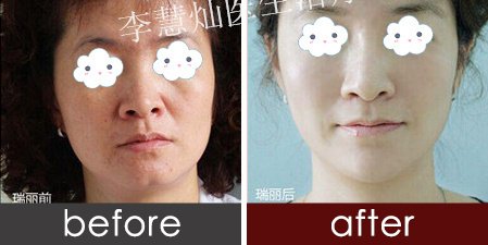 https://img.yiyiaimei.com/timg/160222/1A23a201-0.jpg