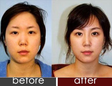 https://img.yiyiaimei.com/timg/160222/1A241DC-0.jpg