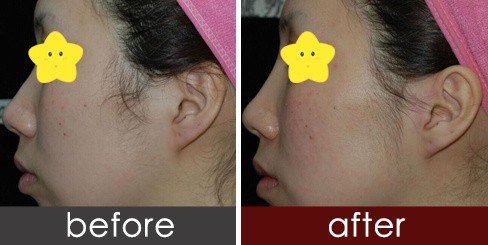 https://img.yiyiaimei.com/timg/160222/1A243K13-0.jpg