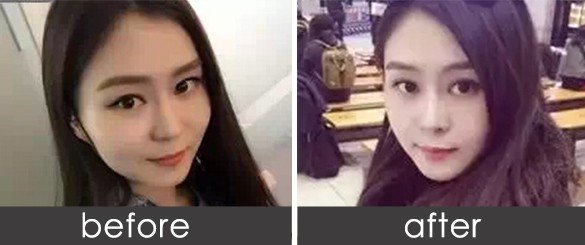 案例图片
