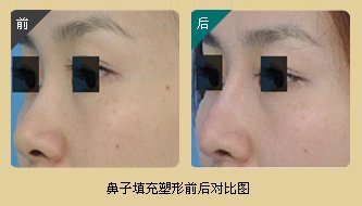 https://img.yiyiaimei.com/timg/160222/1A2543W8-0.jpg