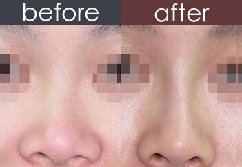 https://img.yiyiaimei.com/timg/160222/1A25A522-0.jpg