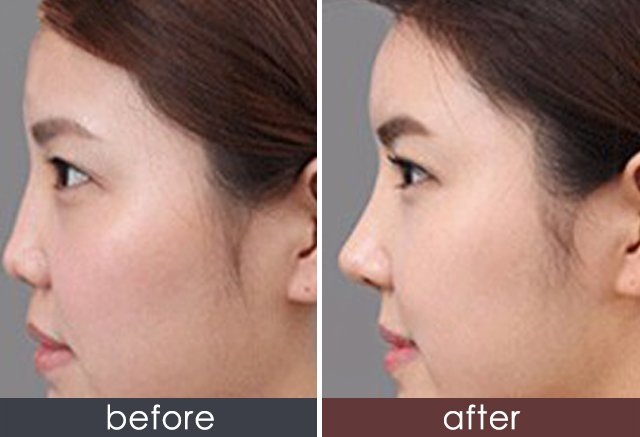 https://img.yiyiaimei.com/timg/160222/1A25a613-0.jpg