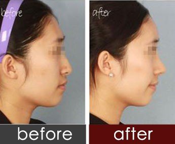 https://img.yiyiaimei.com/timg/160222/1A305D03-1.jpg