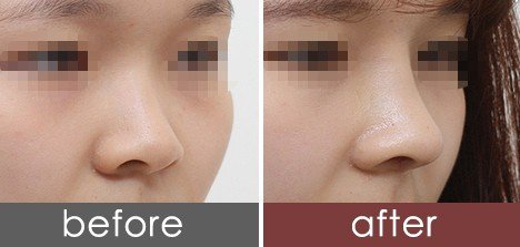 https://img.yiyiaimei.com/timg/160222/1A30M592-0.jpg