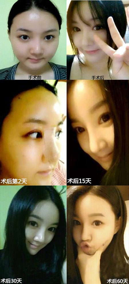 案例图片