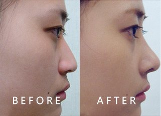 https://img.yiyiaimei.com/timg/160222/1A3301301-0.jpg