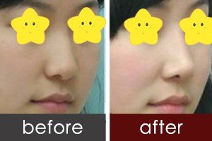https://img.yiyiaimei.com/timg/160222/1A33WJ7-0.jpg