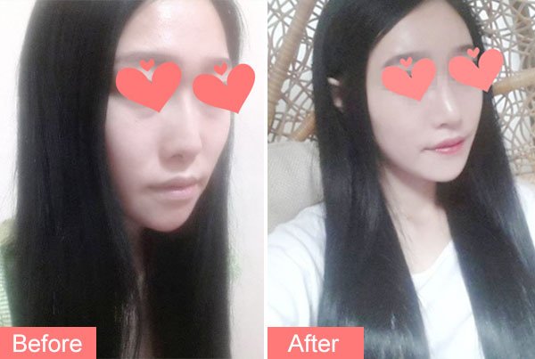 https://img.yiyiaimei.com/timg/160222/1A34QD9-1.jpg