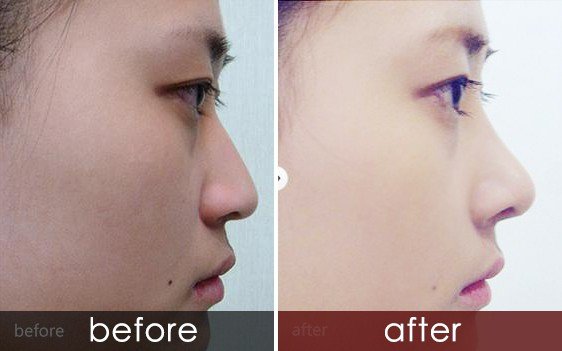 https://img.yiyiaimei.com/timg/160222/1A34S209-0.jpg