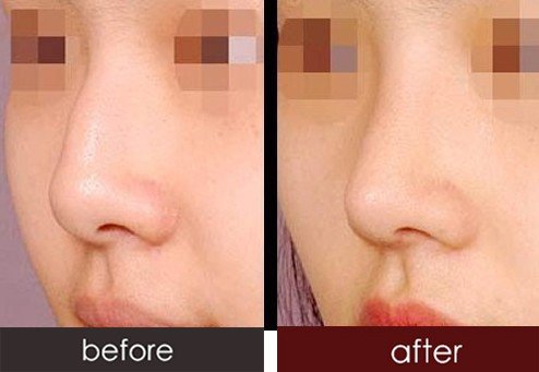 https://img.yiyiaimei.com/timg/160222/1A3514353-0.jpg