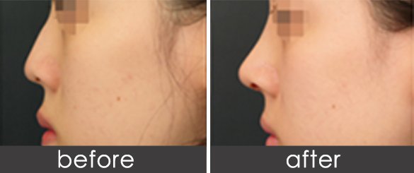https://img.yiyiaimei.com/timg/160222/1A3592434-1.jpg