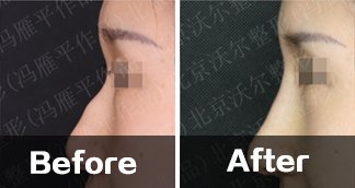 https://img.yiyiaimei.com/timg/160222/1A4132518-0.jpg