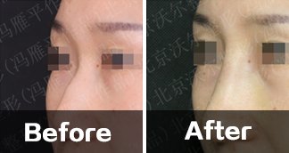 https://img.yiyiaimei.com/timg/160222/1A4135645-1.jpg