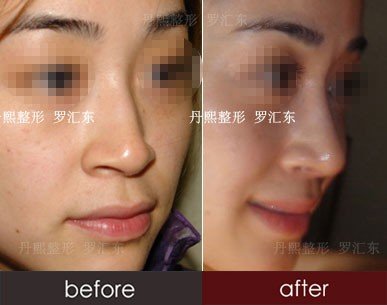 https://img.yiyiaimei.com/timg/160222/1A4161041-2.jpg