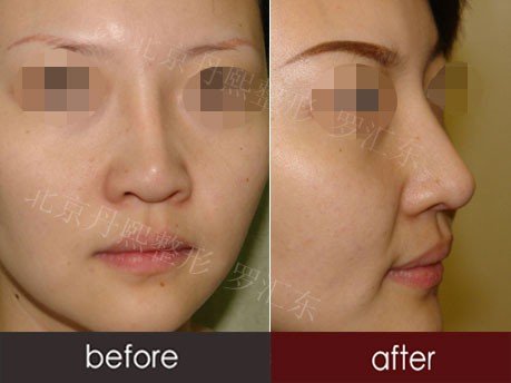 https://img.yiyiaimei.com/timg/160222/1A4164543-0.jpg