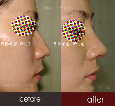 https://img.yiyiaimei.com/timg/160222/1A41H5M-3.jpg