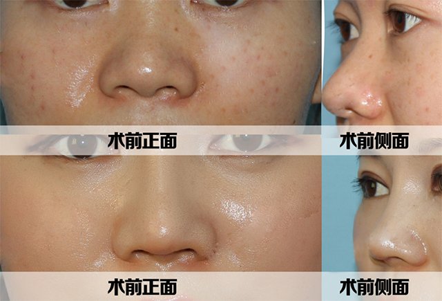 https://img.yiyiaimei.com/timg/160222/1A41J591-0.jpg