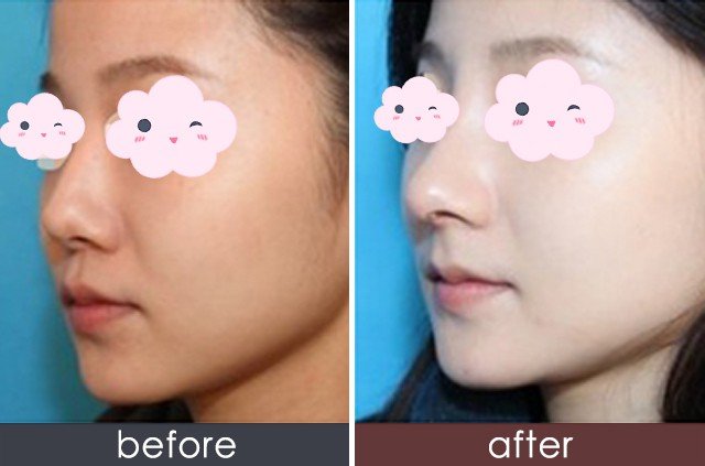 https://img.yiyiaimei.com/timg/160222/1A41S418-0.jpg