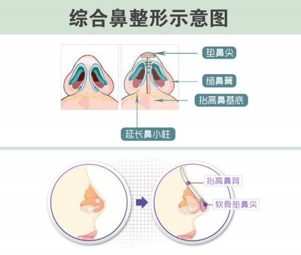 案例图片