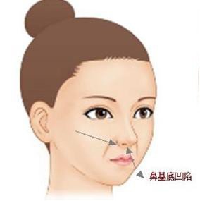 案例图片
