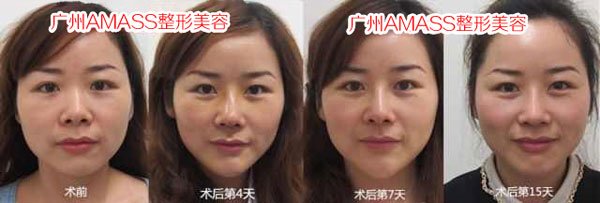 https://img.yiyiaimei.com/timg/160222/1A4363507-0.jpg