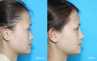 https://img.yiyiaimei.com/timg/160222/1A43ab0-0.jpg