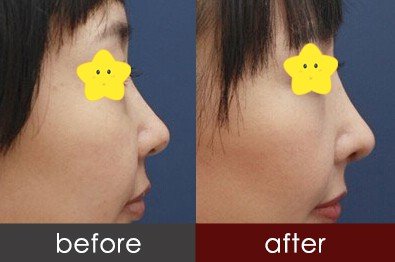 https://img.yiyiaimei.com/timg/160222/1A4425231-0.jpg