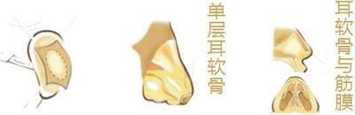 https://img.yiyiaimei.com/timg/160222/1A4442509-2.jpg