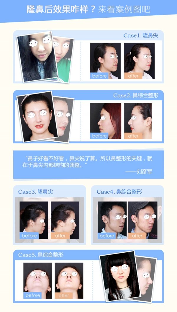 案例图片