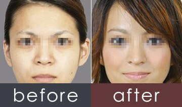 https://img.yiyiaimei.com/timg/160222/1A51R456-0.jpg
