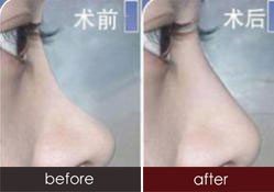 案例图片