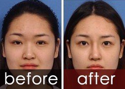 https://img.yiyiaimei.com/timg/160222/1A5253a6-0.jpg