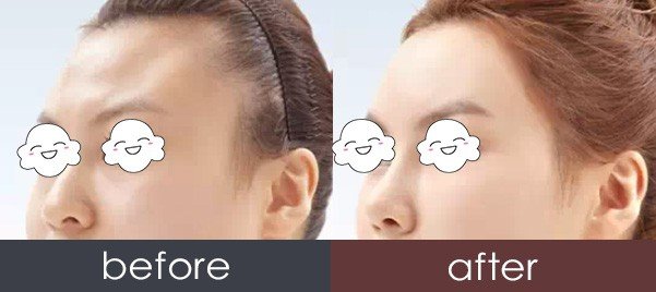 https://img.yiyiaimei.com/timg/160222/1A5355105-0.jpg
