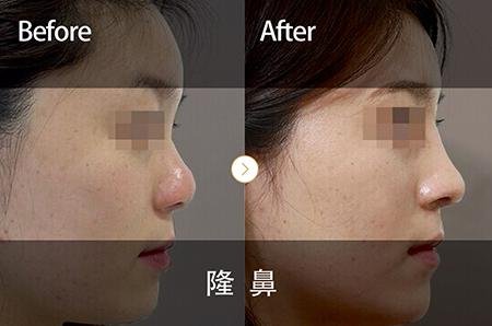 https://img.yiyiaimei.com/timg/160222/1A5405602-0.jpg