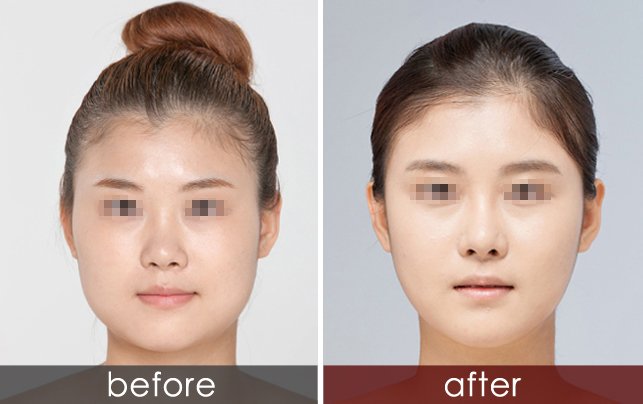 https://img.yiyiaimei.com/timg/160222/1F2024115-1.jpg