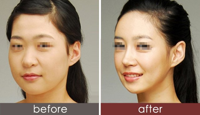 https://img.yiyiaimei.com/timg/160222/1F2034G9-2.jpg